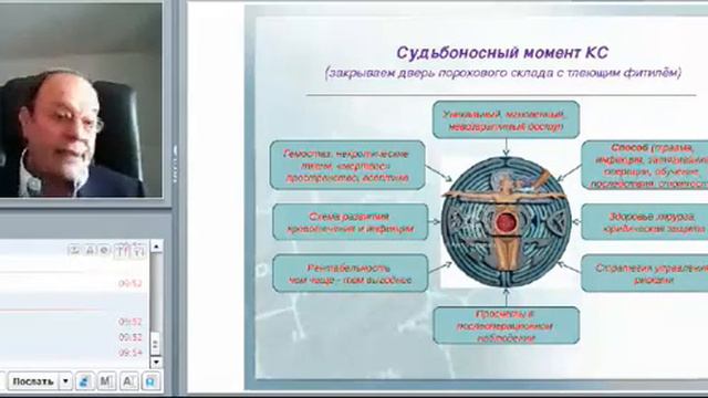 Жуковский презентация Екатеринбург 18 марта 2013 Кесарево сечение смотреть онлайн