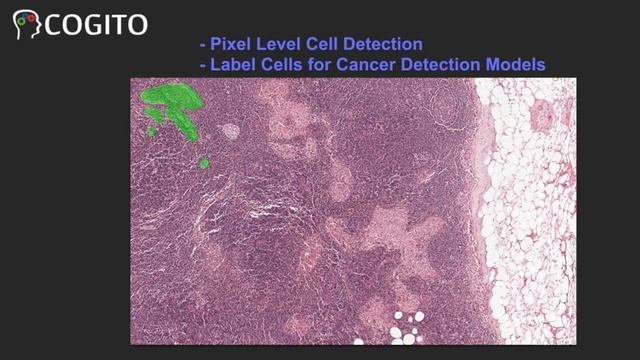 Data Labeling in ML Project for Cancer Cell Detection, Cancer Prediction and Prognosis смотреть онлайн