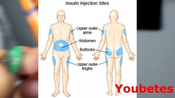 Novorapid Flexpen 3ml with 4mm needle - Diabetes Type 1
