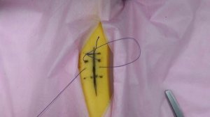 непрерывный обвивной шов (техника; как наложить)