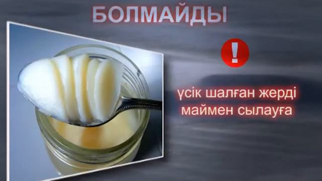Обморожение KZ смотреть онлайн