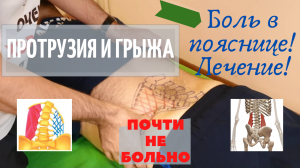 Боль в пояснице. Поясничная протрузия и грыжа. Лечение. Массаж