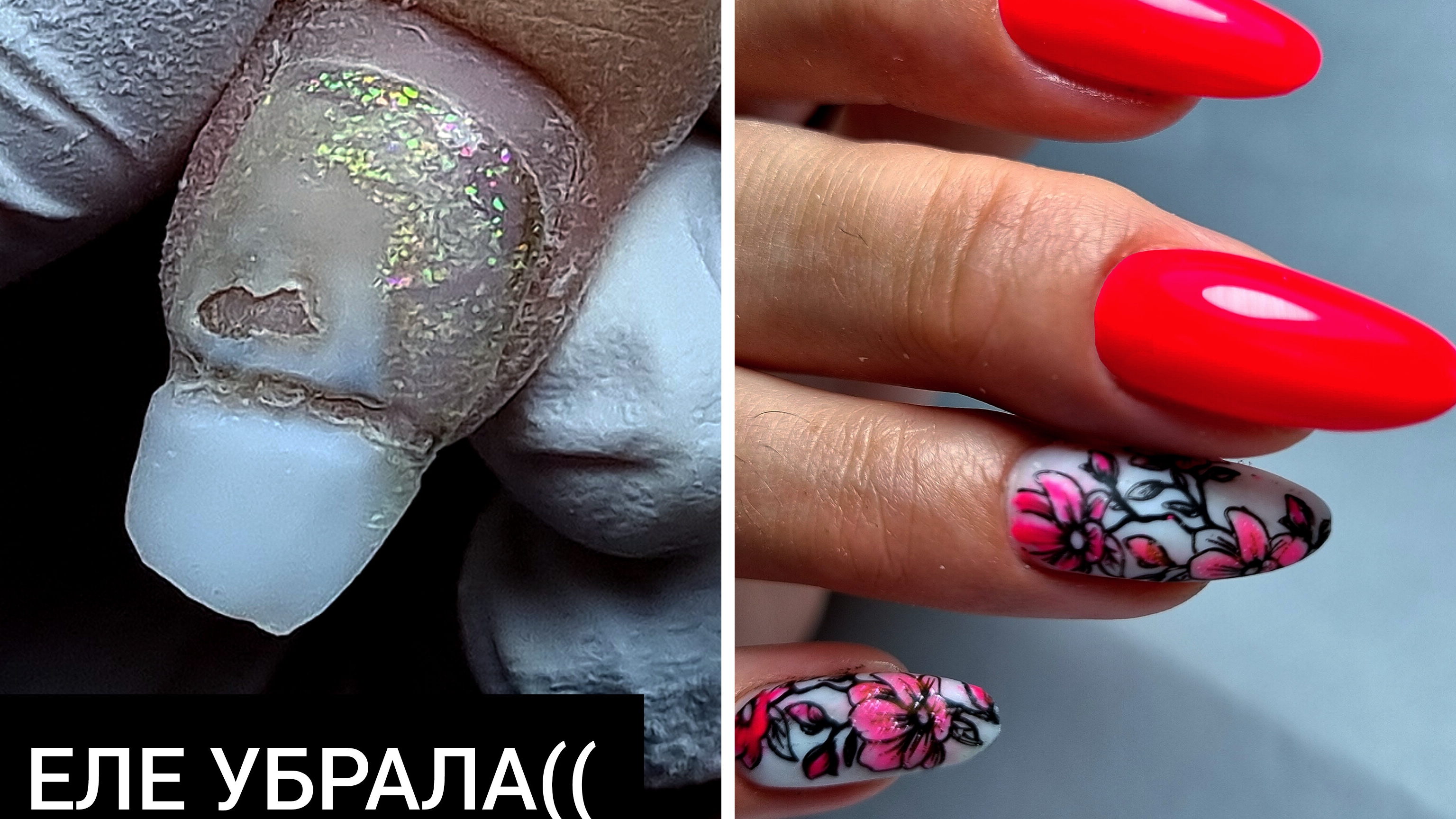 УЖАСНАЯ отслойка