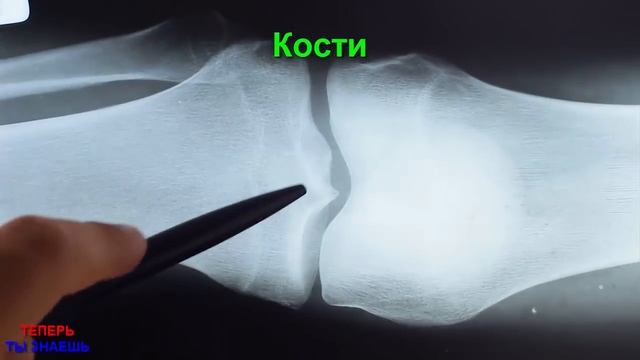 ✅ЗАМОЧИТЕ Миндаль на НОЧЬ в Воде и Съешьте Это УТРОМ! Вот Что СДЕЛАЕТ с Вами Миндаль! смотреть онлайн