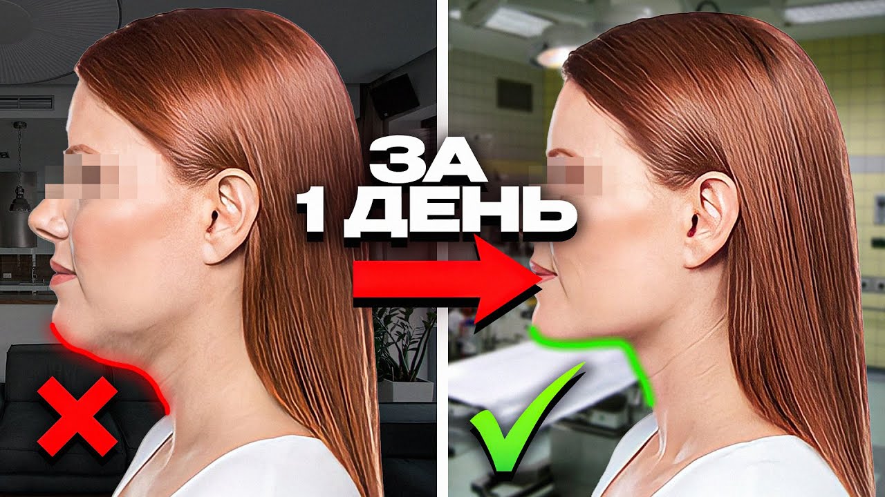 Как избавиться от второго подбородка за 1 день без жестких диет и спорта смотреть онлайн