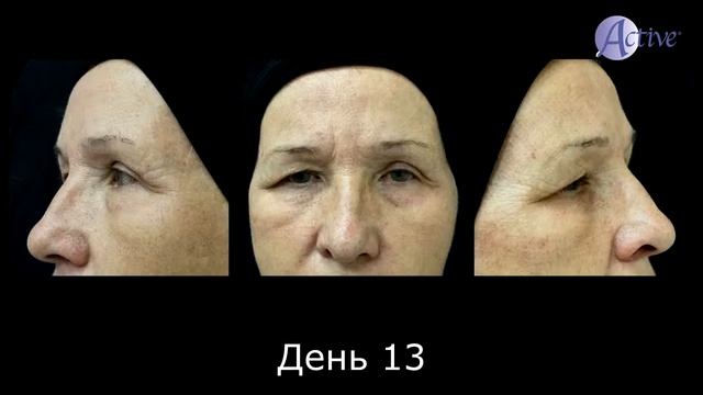 Отзыв BodyShape (Доклад Фуниковой Анны) смотреть онлайн