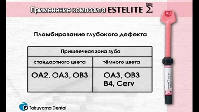 Estelite Sigma смотреть онлайн