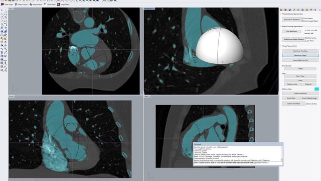 Rhino3DMedical Tutorial: Overview of images, masks and IO operations смотреть онлайн