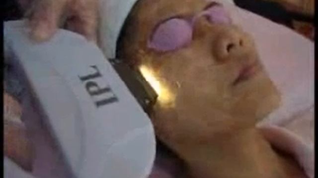 IPL skin rejuvenation.wmv смотреть онлайн
