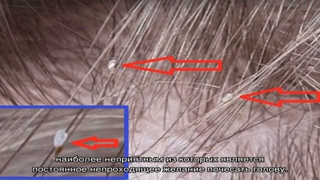 Лечение и симптомы болезней