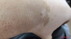 Разбор автомобиля Сан Енг Актион для установки авточехлов с выниманием сидений, снятием пластика...