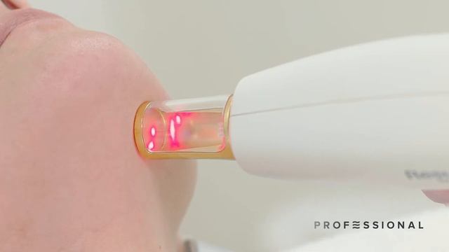Доктор Олеся Загорулько проводит лазерное омоложение лица и рук ResurFX + Плазмолифтинг смотреть онлайн