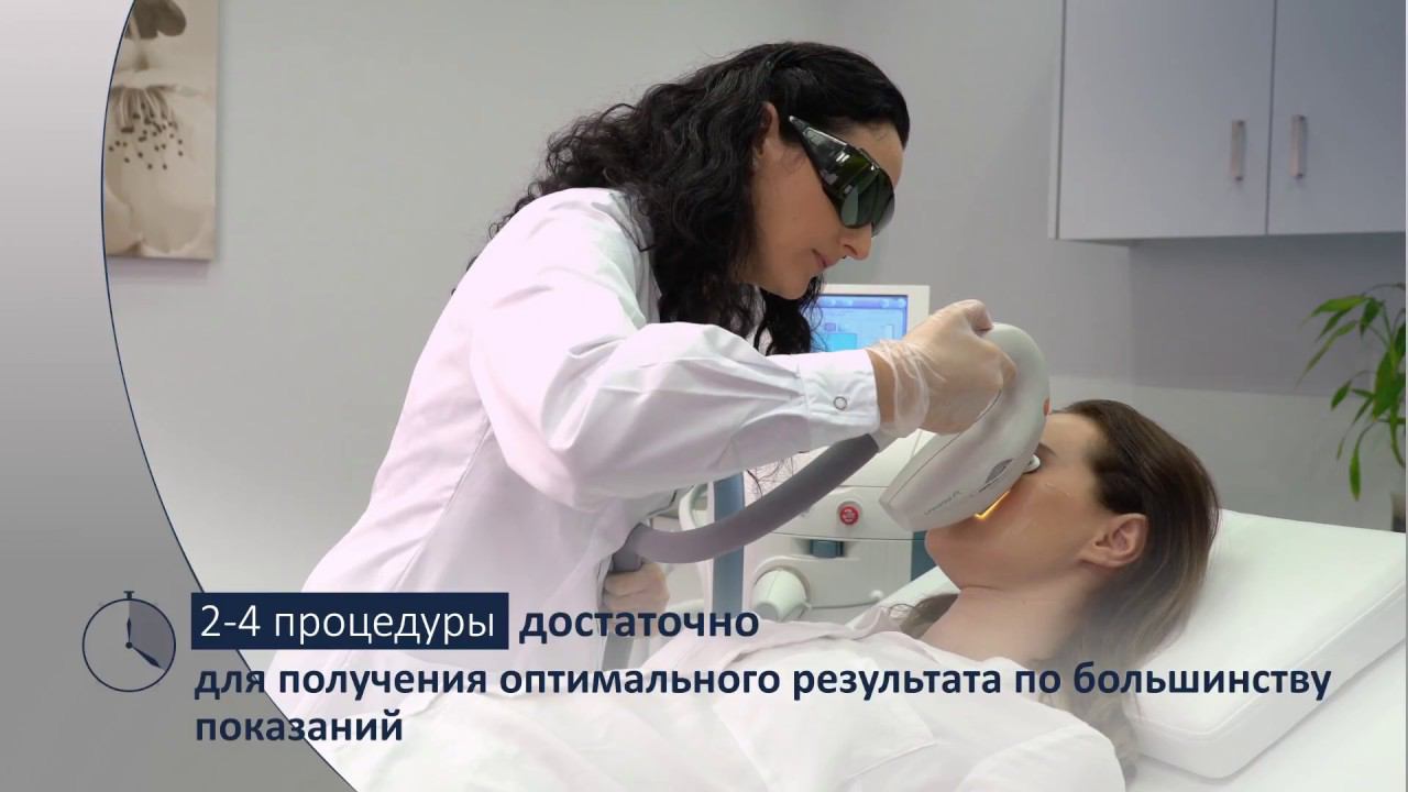 IPL-терапия: от пигментации, сосудов + фотоомоложение! смотреть онлайн