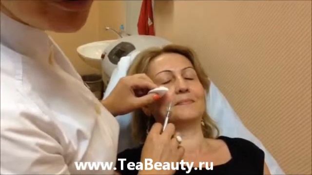 Коррекция носогубных складок смотреть онлайн