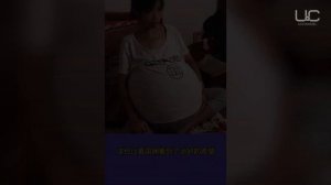 У ЖЕНЩИНЫ ВЫРОС АНОМАЛЬНЫЙ ЖИВОТ ОТ НЕИЗВЕСТНОЙ БОЛЕЗНИ