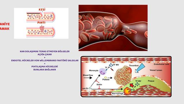 Damarda Pıhtı, Nasıl Olur? Sağlık, Prof.Dr.Serdar Akgün,Tıp Videoları смотреть онлайн