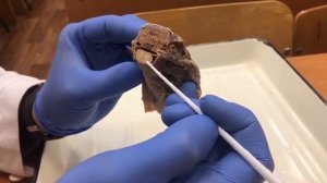 Спинной мозг