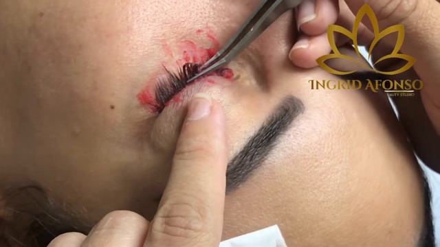 Remoção da Extensão de Cílios смотреть онлайн