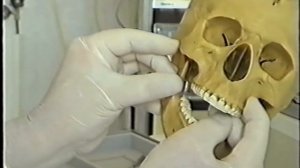 Проводниковая анестезия по Егорову