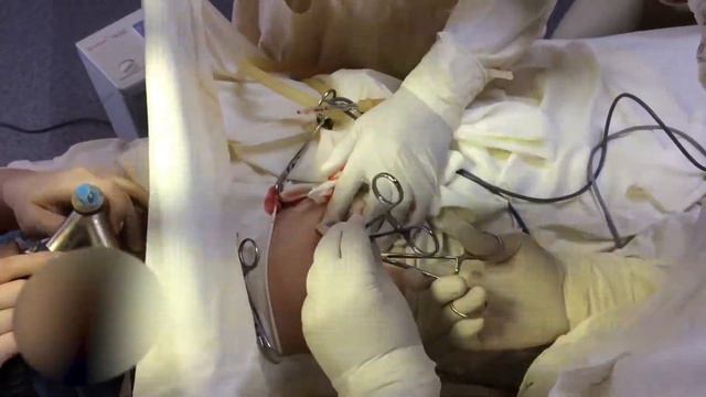 Резекция Молочной железы смотреть онлайн