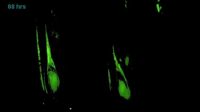 Развитие возбудителя фузариоза на колосе смотреть онлайн