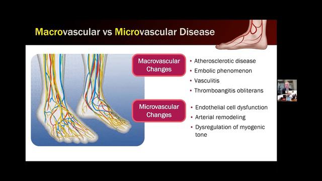 What Is Peripheral Arterial Disease (PAD)? | PAD Symptoms смотреть онлайн