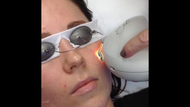 Live IPL Treatment смотреть онлайн