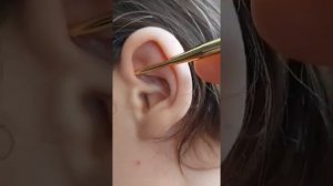 шелушение, зуд, в полости раковины уха. Что бы это значило?