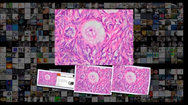 Ученые описали второй случай рождения полуторазиготных близнецов смотреть онлайн