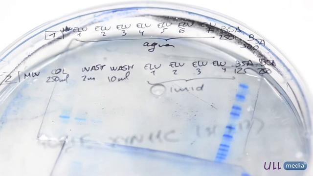 Botrytis cinerea: Un enemigo de nuestra agricultura смотреть онлайн