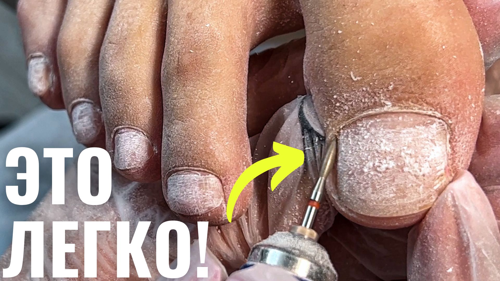 УДАЛЯЮ СУХИЕ И ПОДНОГТЕВЫЕ МОЗОЛИ! ПОДРОБНО про ПЕДИКЮР для новичков! смотреть онлайн