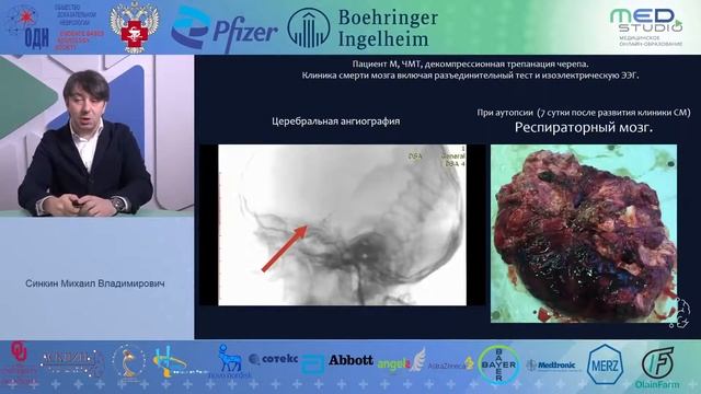 Инструментальные методы диагностики смерти мозга. Синкин МВ