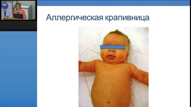Мастер-класс по детской аллергологии и иммунологии - 3 смотреть онлайн