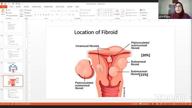 Fibroid Uterus | (part-1) смотреть онлайн