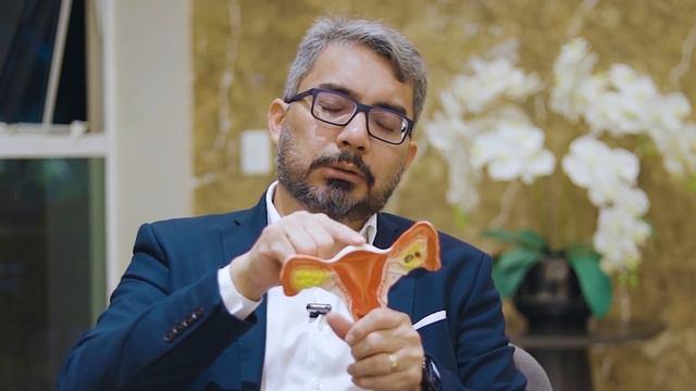 MIOMA NO ÚTERO: QUANDO SE PREOCUPAR? смотреть онлайн