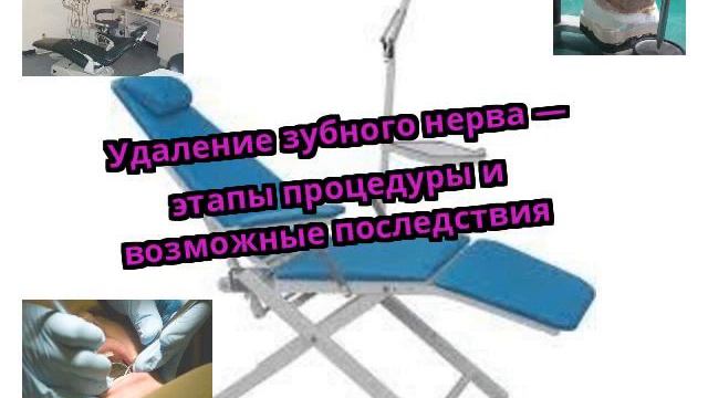 Удаление зубного нерва — этапы процедуры и возможные последствия смотреть онлайн