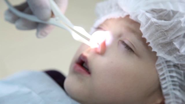 Успешное лечение в Краснодаре аденоидной вегетации у детей смотреть онлайн