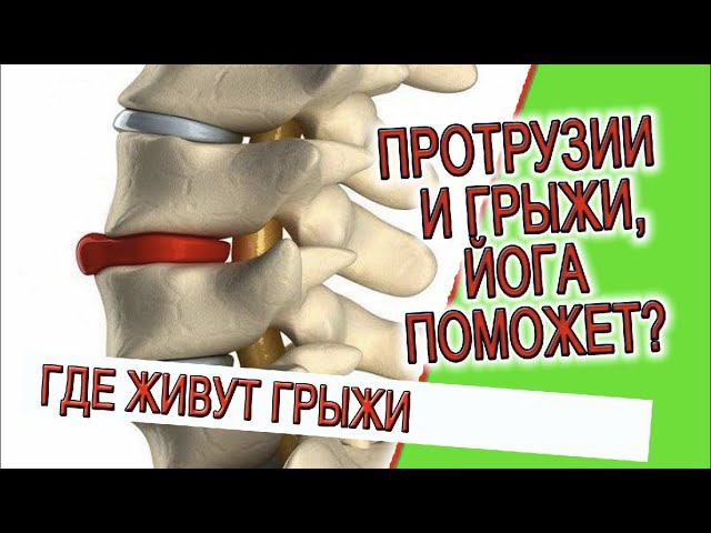 Протрузии и грыжи, йога поможет? смотреть онлайн