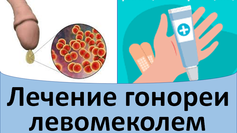 Самолечение гонореи мазью левомеколь смотреть онлайн