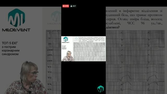 5 ЕКГ ГКС смотреть онлайн