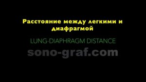 УЗИ - Определение объема плеврального выпота