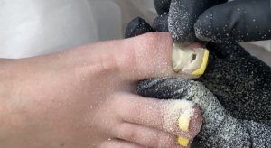 Нельзя наращивать ногти на ногах