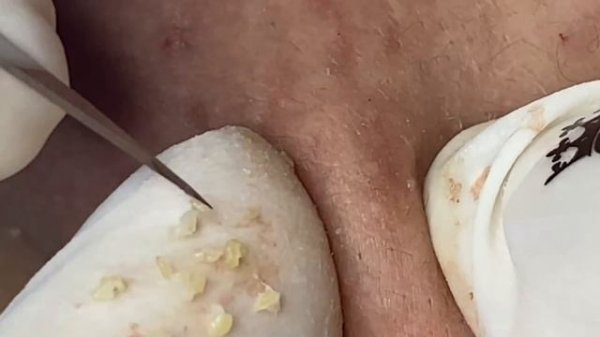 Relax Every Day With Sac Dep Spa #0161