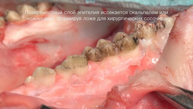 7. 2. Лечение множественных рецессий смотреть онлайн