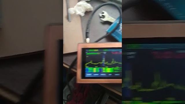 Магнитно-рамочная антенна для кв смотреть онлайн