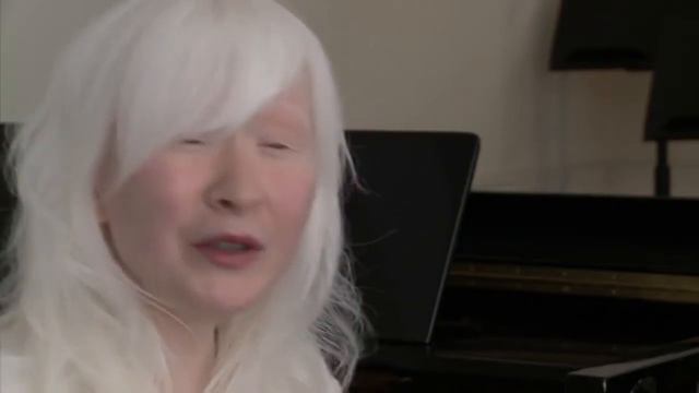 Asian Albinism Model and Singer смотреть онлайн