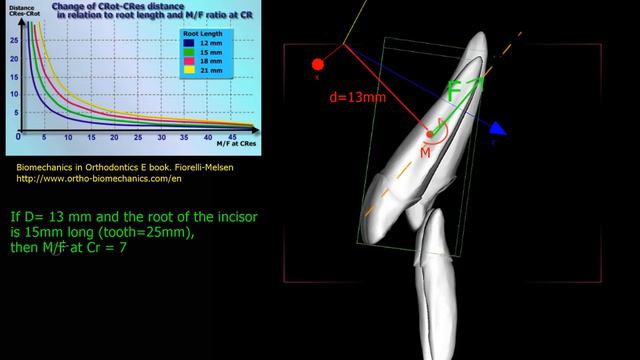 center or rotation mechanics in orthodontic tooth movement смотреть онлайн