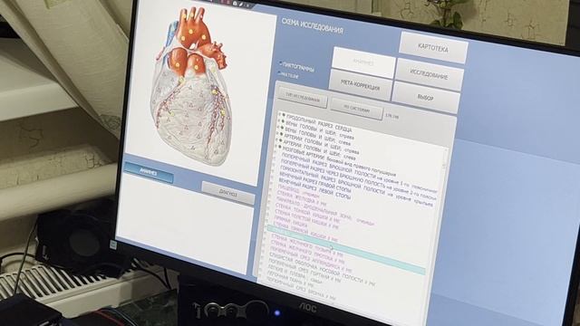 Чаши Жизни. Тест Плазмы М.Кеше. Исследования Биорезонансом. Биопатриот центр. Новороссийск. смотреть онлайн