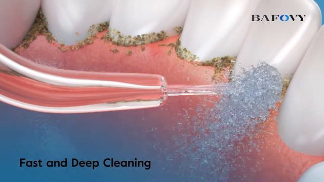 BAFOVY BF-WF01 portable water flosser смотреть онлайн