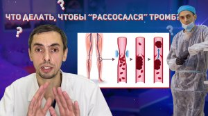 Что делать, чтобы "рассосался" тромб?? #варикоз #флеболог #тромбоз